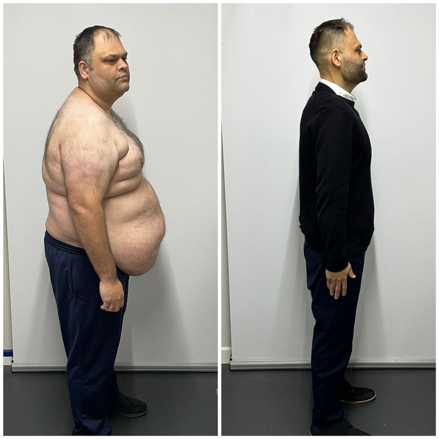 Client transformation